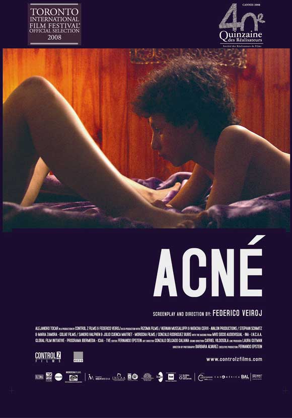 Acne movie