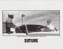 Suture - 8 x 10 B&W Photo #8
