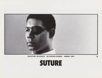 Suture - 8 x 10 B&W Photo #4